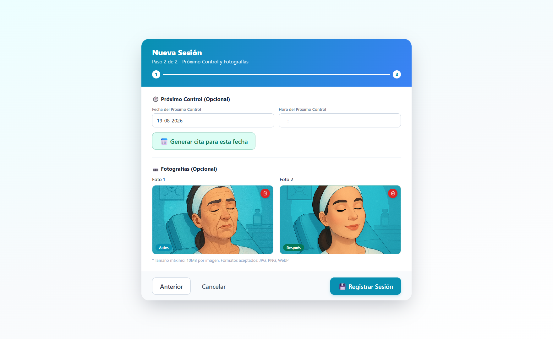 Modal de nueva sesión estética con carga de fotografías antes y después