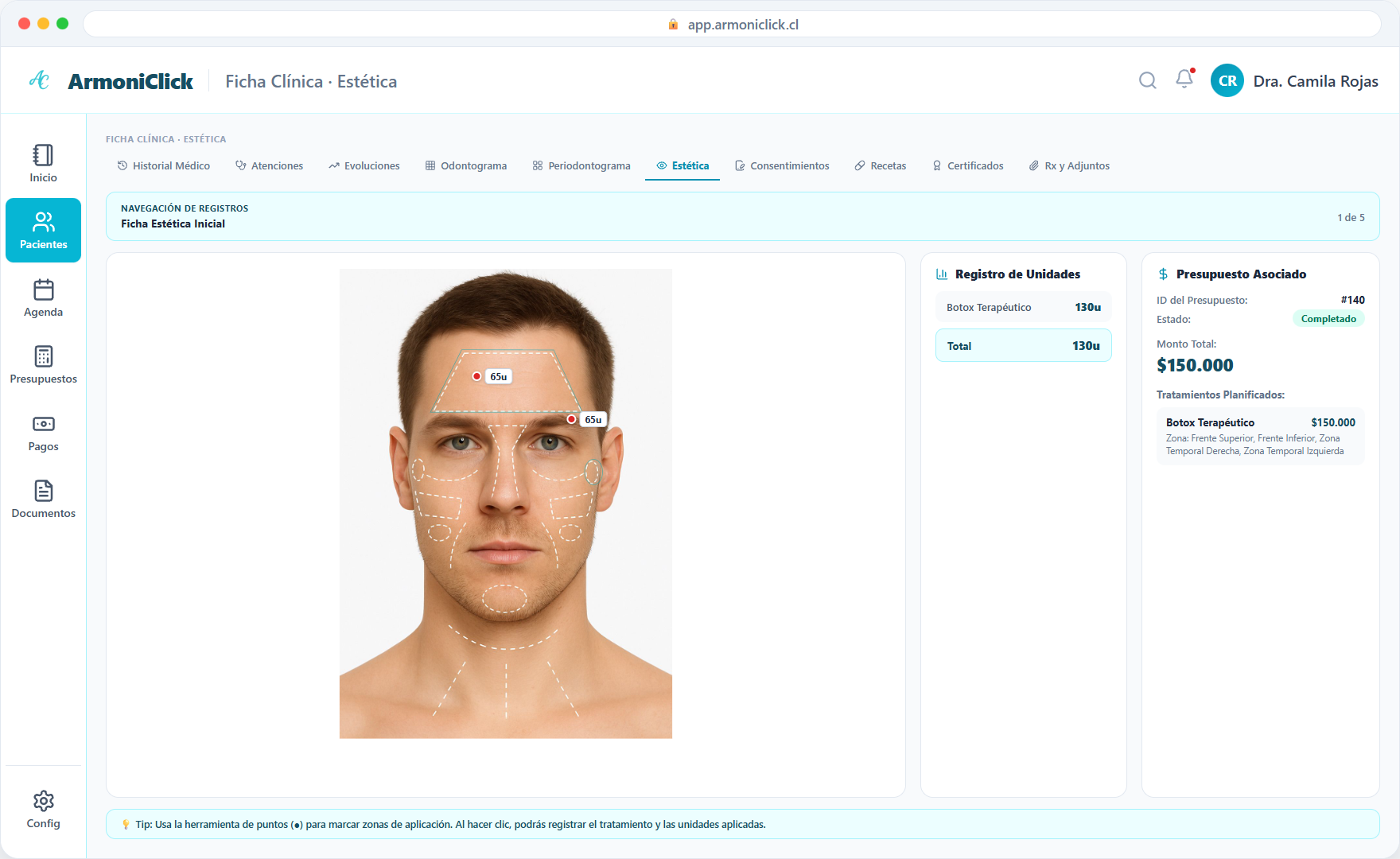 Registro de unidades de producto aplicadas por zona facial con presupuesto asociado